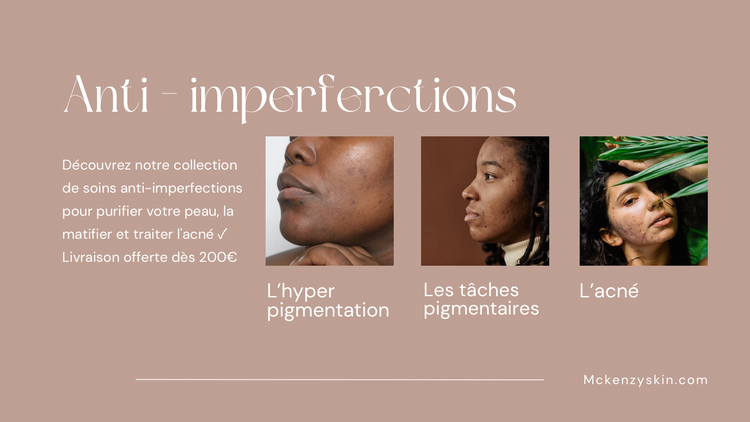 Anti-imperfections